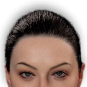 Implanted Hair